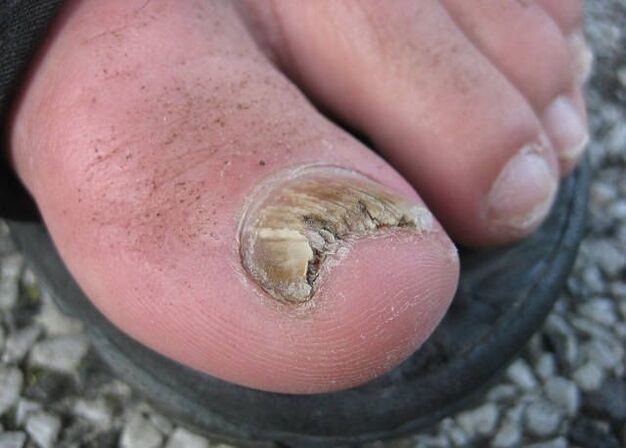 Rezultat zanemarivanja