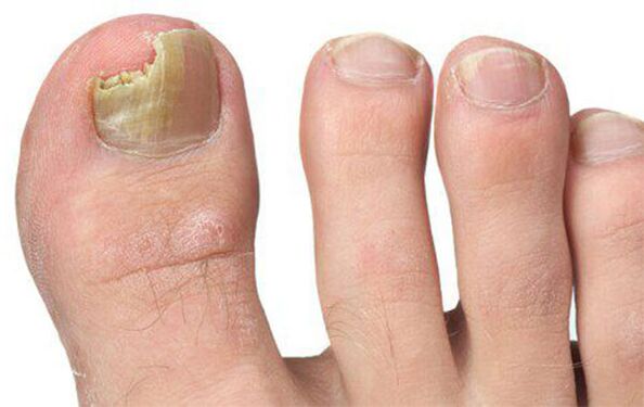 Različiti oblici gljivica