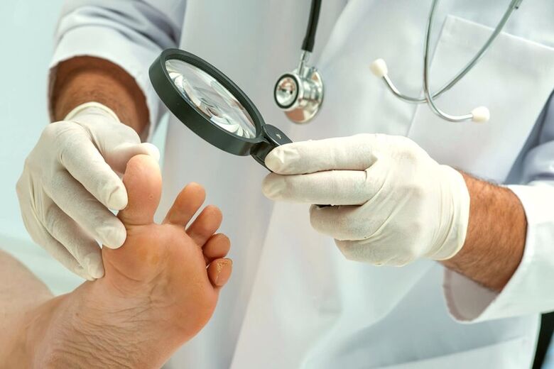 dermatolog koji pregledava nokte na nogama