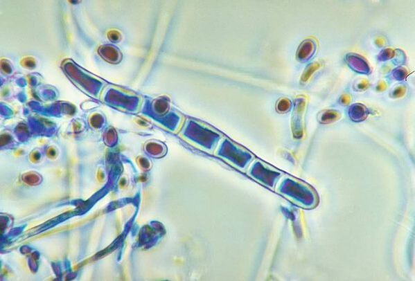 Gljiva Trichophyton rubrum pod mikroskopom